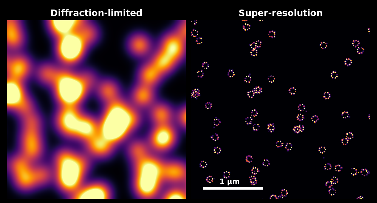 Left: a diffraction-limited image. Right: the super-resolution reconstruction, resolving 8-mer rings.